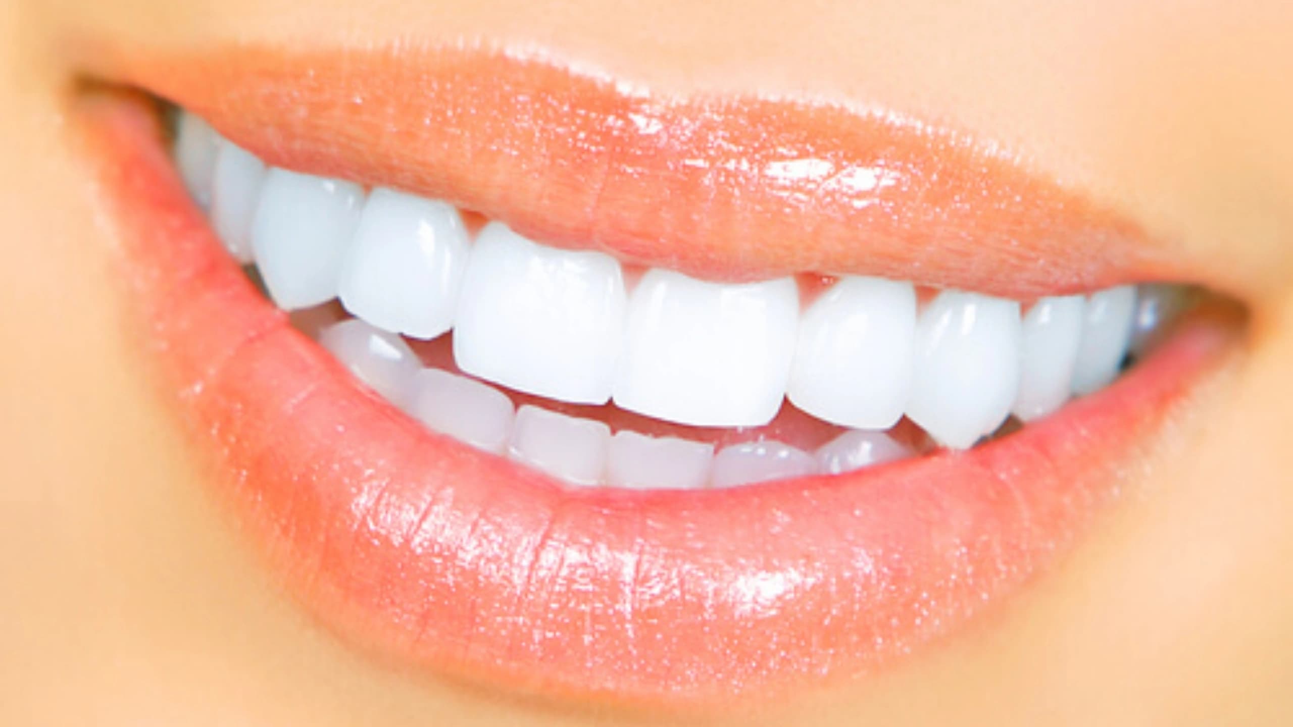 Obtenez un sourire éclatant digne des stars avec notre traitement de sourire hollywoodien en Albanie.